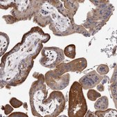 Anti-ALPK1 antibody produced in rabbit Prestige Antibodies® Powered by Atlas Antibodies, affinity isolated antibody, buffered aqueous glycerol solution, ab1