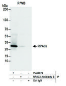 Rabbit anti-RPA32 Antibody, Affinity Purified Powered by Bethyl Laboratories, Inc.