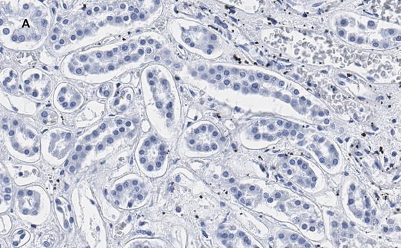 Anti-Smad3 Antibody, clone 1J11, ZooMAb&#174; Rabbit Monoclonal recombinant, expressed in HEK 293 cells