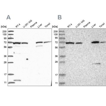 Anti-RNPEP antibody produced in rabbit Prestige Antibodies&#174; Powered by Atlas Antibodies, affinity isolated antibody, buffered aqueous glycerol solution