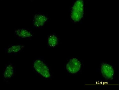 Anti-NARG2 antibody produced in mouse IgG fraction of antiserum, buffered aqueous solution