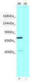 Anti-SEZ6 (C-terminal) antibody produced in rabbit affinity isolated antibody
