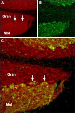 Anti-TRPC1 antibody produced in rabbit affinity isolated antibody, lyophilized powder