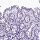 Anti-FAM169A antibody produced in rabbit Prestige Antibodies® Powered by Atlas Antibodies, affinity isolated antibody, buffered aqueous glycerol solution