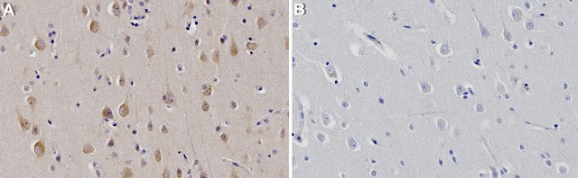 Anti-TAOK2 Antibody, clone 1N9 ZooMAb&#174; Rabbit Monoclonal recombinant, expressed in HEK 293 cells