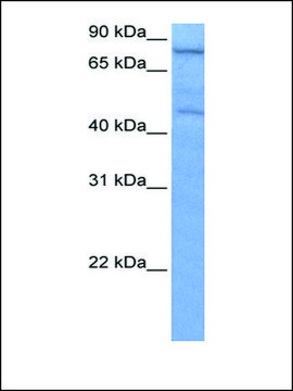 Anti-ZNF555 (AB4) antibody produced in rabbit affinity isolated antibody