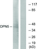 Anti-OPN5 antibody produced in rabbit affinity isolated antibody