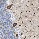 Anti-FARS2 antibody produced in rabbit Prestige Antibodies® Powered by Atlas Antibodies, affinity isolated antibody, buffered aqueous glycerol solution
