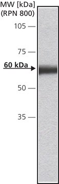 Anti-Calsequestrin-1 (N-terminal) antibody produced in rabbit affinity isolated antibody