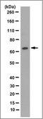 Anti-HNF-1-beta Antibody, clone 12A5.1 clone 12A5.1, from mouse