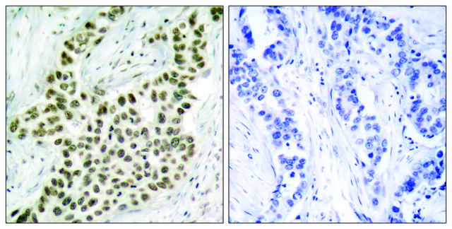 Anti-Histone H2A.X antibody produced in rabbit affinity isolated antibody