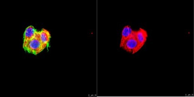 Anti-Cytokeratin 8 Antibody, clone TROMA-1 clone TROMA-1, from rat