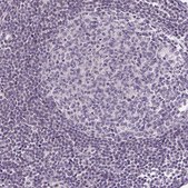 Anti-SLC2A9 antibody produced in rabbit Prestige Antibodies® Powered by Atlas Antibodies, affinity isolated antibody, buffered aqueous glycerol solution