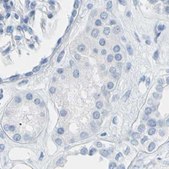 Anti-OPN1SW antibody produced in rabbit Prestige Antibodies® Powered by Atlas Antibodies, affinity isolated antibody