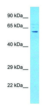 Anti-ACVR2B (C-terminal) antibody produced in rabbit affinity isolated antibody