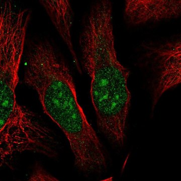 Anti-ESF1 antibody produced in rabbit Prestige Antibodies&#174; Powered by Atlas Antibodies, affinity isolated antibody