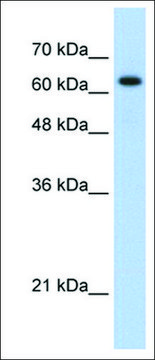 Anti-RAD17 antibody produced in rabbit IgG fraction of antiserum