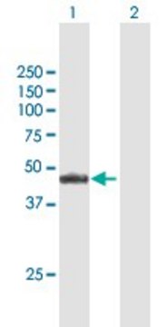 Anti-NR2E3 antibody produced in mouse purified immunoglobulin, buffered aqueous solution