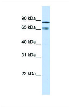 Anti-IKZF1 antibody produced in rabbit affinity isolated antibody