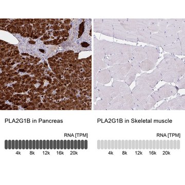 Anti-PLA2G1B antibody produced in rabbit Prestige Antibodies&#174; Powered by Atlas Antibodies, affinity isolated antibody, buffered aqueous glycerol solution