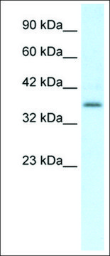 Anti-CMKLR1 antibody produced in rabbit affinity isolated antibody