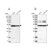 Anti-HADHB antibody produced in rabbit Prestige Antibodies® Powered by Atlas Antibodies, affinity isolated antibody, buffered aqueous glycerol solution