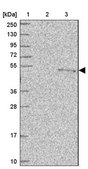 Anti-PUS1 antibody produced in rabbit Prestige Antibodies® Powered by Atlas Antibodies, affinity isolated antibody, buffered aqueous glycerol solution