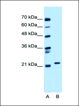 Anti-RAB11B antibody produced in rabbit affinity isolated antibody