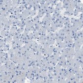 Anti-ITPR1 antibody produced in rabbit Prestige Antibodies® Powered by Atlas Antibodies, affinity isolated antibody, buffered aqueous glycerol solution