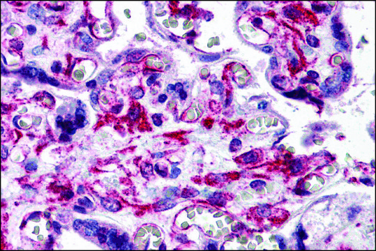 Anti-RUSC2 antibody produced in rabbit affinity isolated antibody