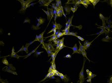 YUMM2.1 Mouse Melanoma Cell Line