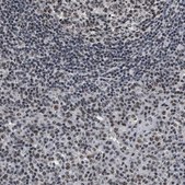 Anti-RRP1B antibody produced in rabbit Prestige Antibodies® Powered by Atlas Antibodies, affinity isolated antibody, buffered aqueous glycerol solution, Ab2