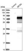 Anti-ZBTB2 antibody produced in rabbit Prestige Antibodies® Powered by Atlas Antibodies, affinity isolated antibody, buffered aqueous glycerol solution, Ab4