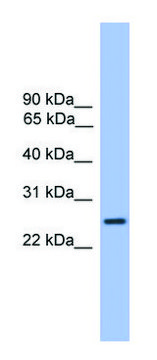 Anti-GOSR1 (C-terminal) antibody produced in rabbit affinity isolated antibody