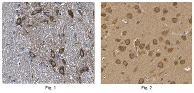 Anti-ELFN1 Antibody from rabbit, purified by affinity chromatography