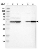 Anti-ACCS antibody produced in rabbit Prestige Antibodies® Powered by Atlas Antibodies, affinity isolated antibody, buffered aqueous glycerol solution, Ab1