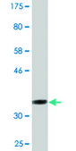 Monoclonal Anti-LIMD1 antibody produced in mouse clone 2G5, purified immunoglobulin, buffered aqueous solution