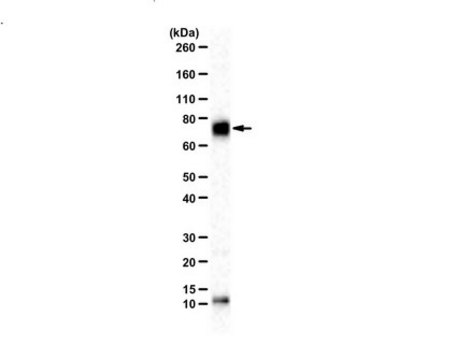 Anti-Acetyl Cortactin (Lys309) from rabbit