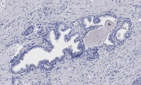 Anti-FOXP1 Antibody, clone 1J11-H1 ZooMAb® Rabbit Monoclonal recombinant, expressed in HEK 293 cells