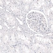 Anti-MLANA antibody produced in mouse Prestige Antibodies® Powered by Atlas Antibodies, clone CL12874, purified by using Protein A, buffered aqueous glycerol solution