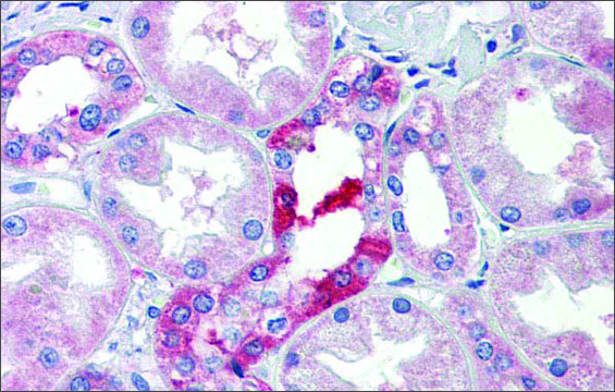 Anti-SLC25A28 antibody produced in rabbit affinity isolated antibody