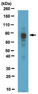 Anti-MeCP2 Antibody from chicken, purified by affinity chromatography