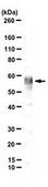 Anti-TdT/DNTT Antibody, clone 41A