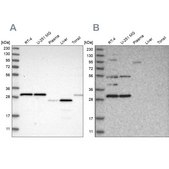 Anti-SCO1 antibody produced in rabbit Prestige Antibodies® Powered by Atlas Antibodies, affinity isolated antibody, buffered aqueous glycerol solution, Ab2