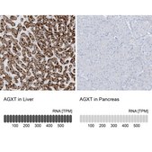 Anti-AGXT antibody produced in rabbit Prestige Antibodies® Powered by Atlas Antibodies, affinity isolated antibody, buffered aqueous glycerol solution