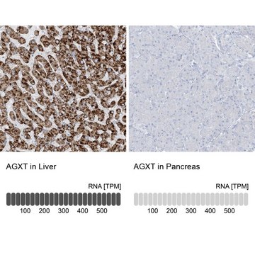 Anti-AGXT antibody produced in rabbit Prestige Antibodies&#174; Powered by Atlas Antibodies, affinity isolated antibody, buffered aqueous glycerol solution