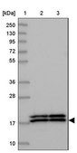 Anti-NME1 antibody produced in rabbit Prestige Antibodies® Powered by Atlas Antibodies, affinity isolated antibody, buffered aqueous glycerol solution