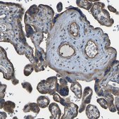 Anti-SLC4A2 antibody produced in rabbit Prestige Antibodies® Powered by Atlas Antibodies, affinity isolated antibody, buffered aqueous glycerol solution