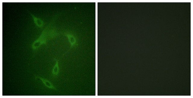 Anti-JAK2 antibody produced in rabbit affinity isolated antibody