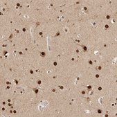 Anti-C1orf21 antibody produced in rabbit Prestige Antibodies® Powered by Atlas Antibodies, affinity isolated antibody, buffered aqueous glycerol solution